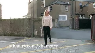 A adolescente escald ...